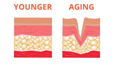the importance of collagen for skin care and how to preserve it